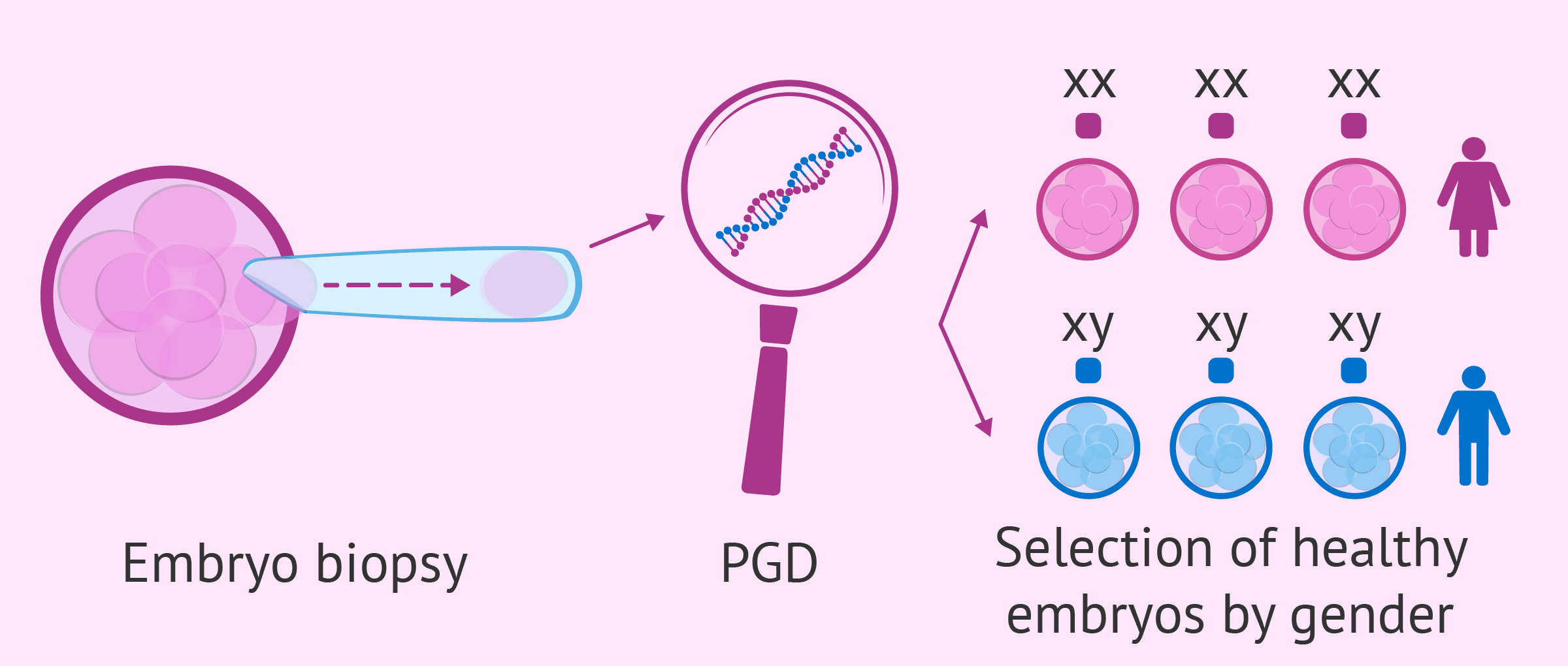 ▷ What Is Preimplantation Genetic Diagnosis (PGD) ᐉ What is